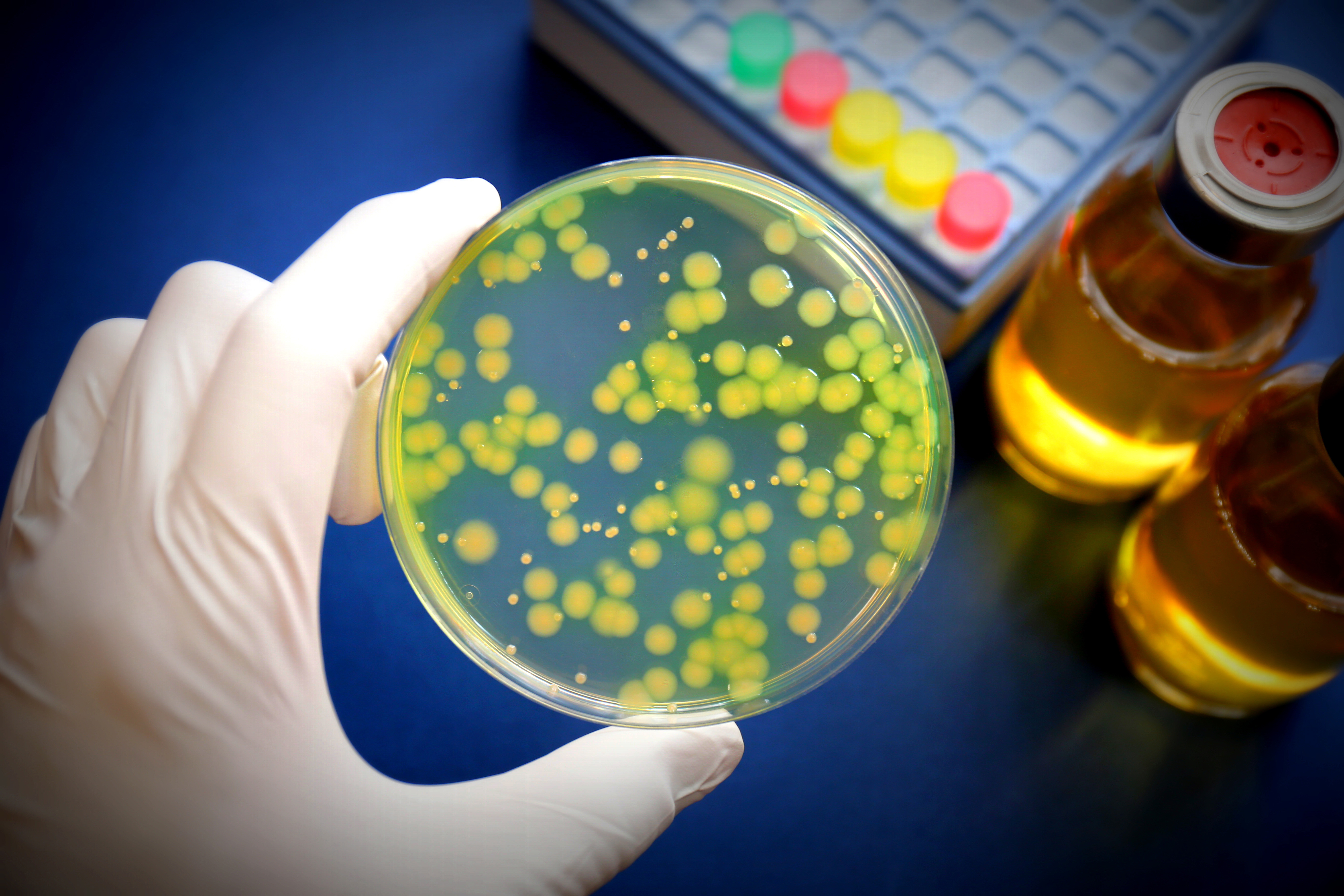 Pseudomonas Test