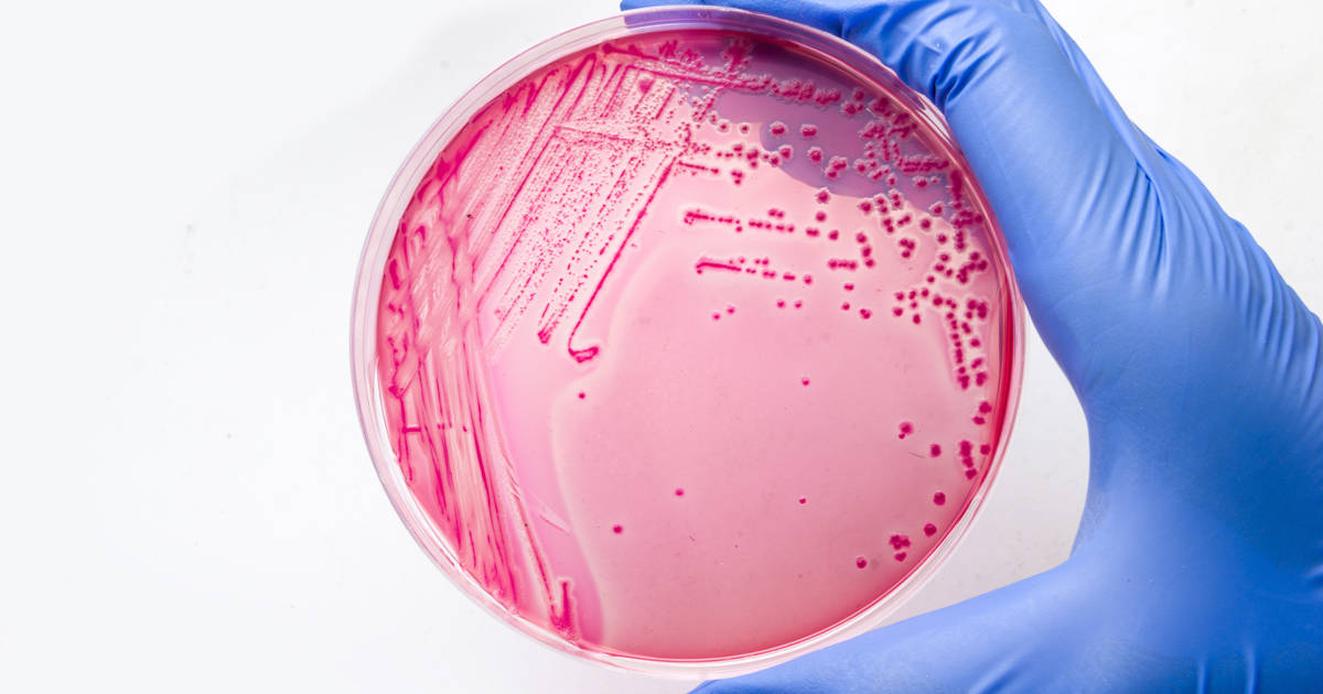 Coliform Bacteria in Water Test | ECT