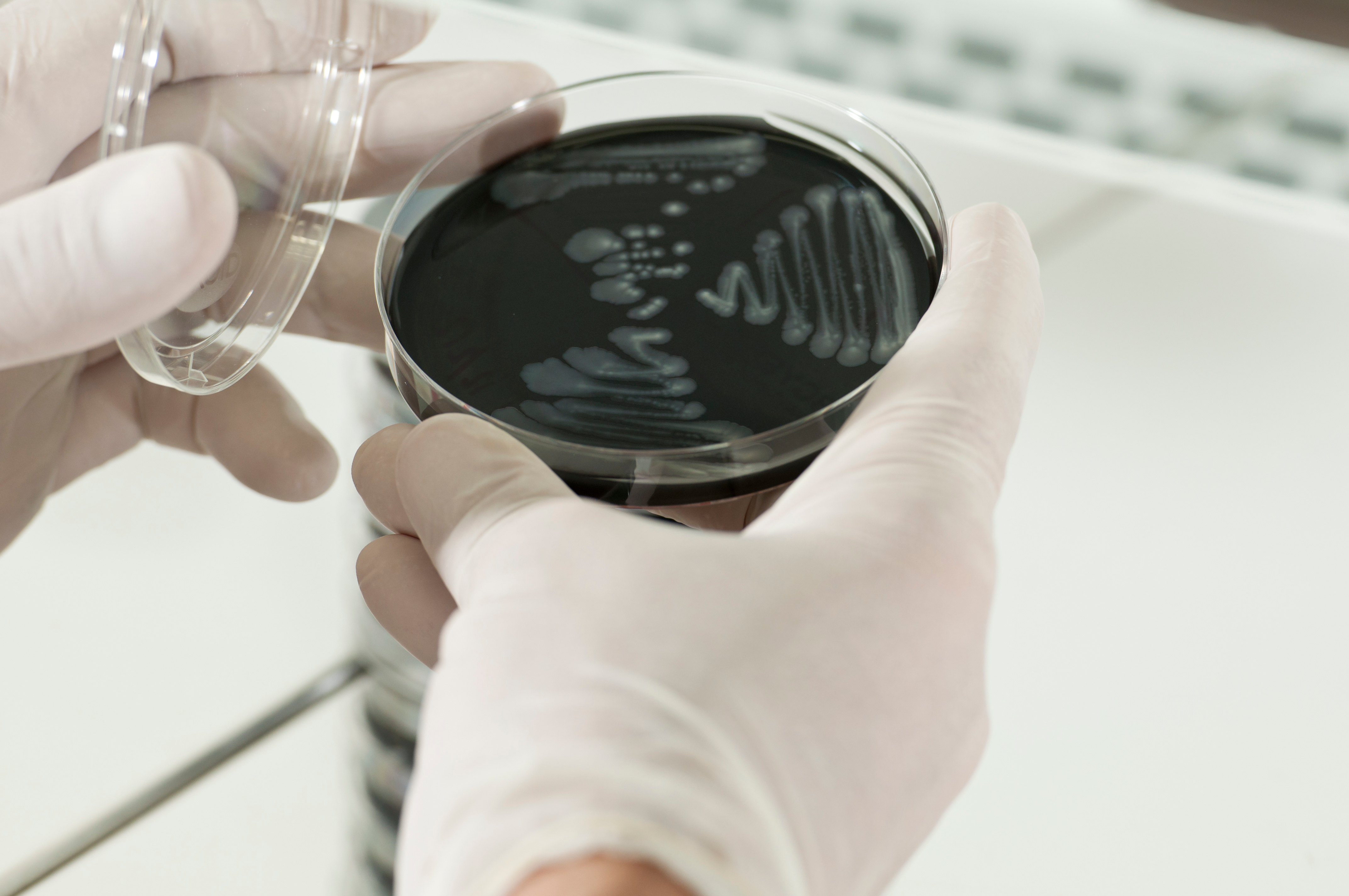 Legionella Testing