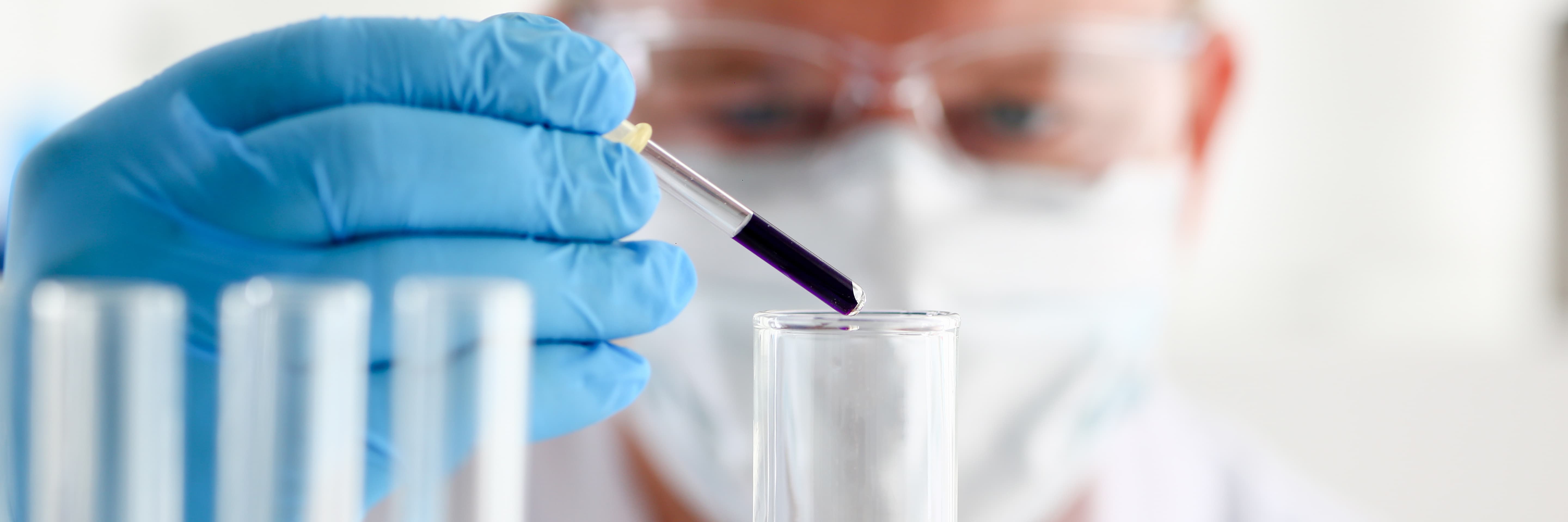 Nitrate-Reducing Bacteria (NRB)